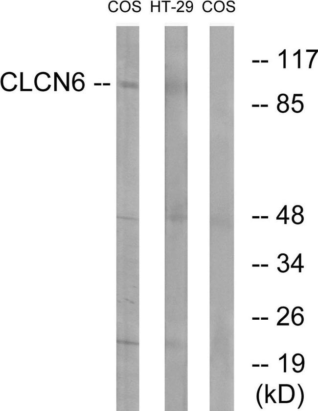 CLCN6 Antibody in Western Blot (WB)