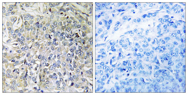 CSGALNACT2 Antibody in Immunohistochemistry (Paraffin) (IHC (P))