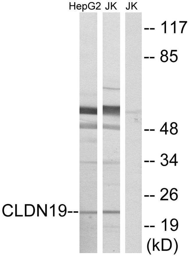 Claudin 19 Antibody in Western Blot (WB)