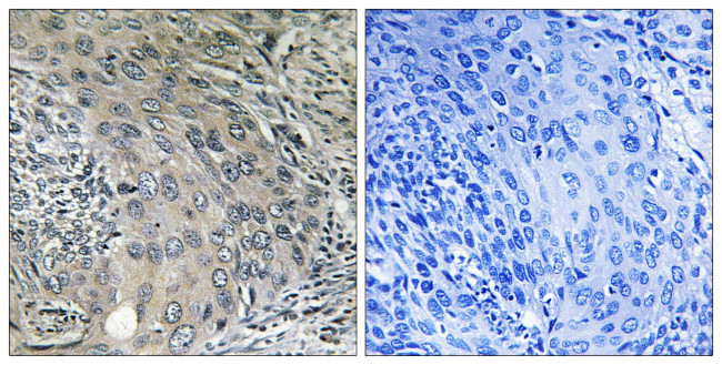 COPZ1 Antibody in Immunohistochemistry (Paraffin) (IHC (P))