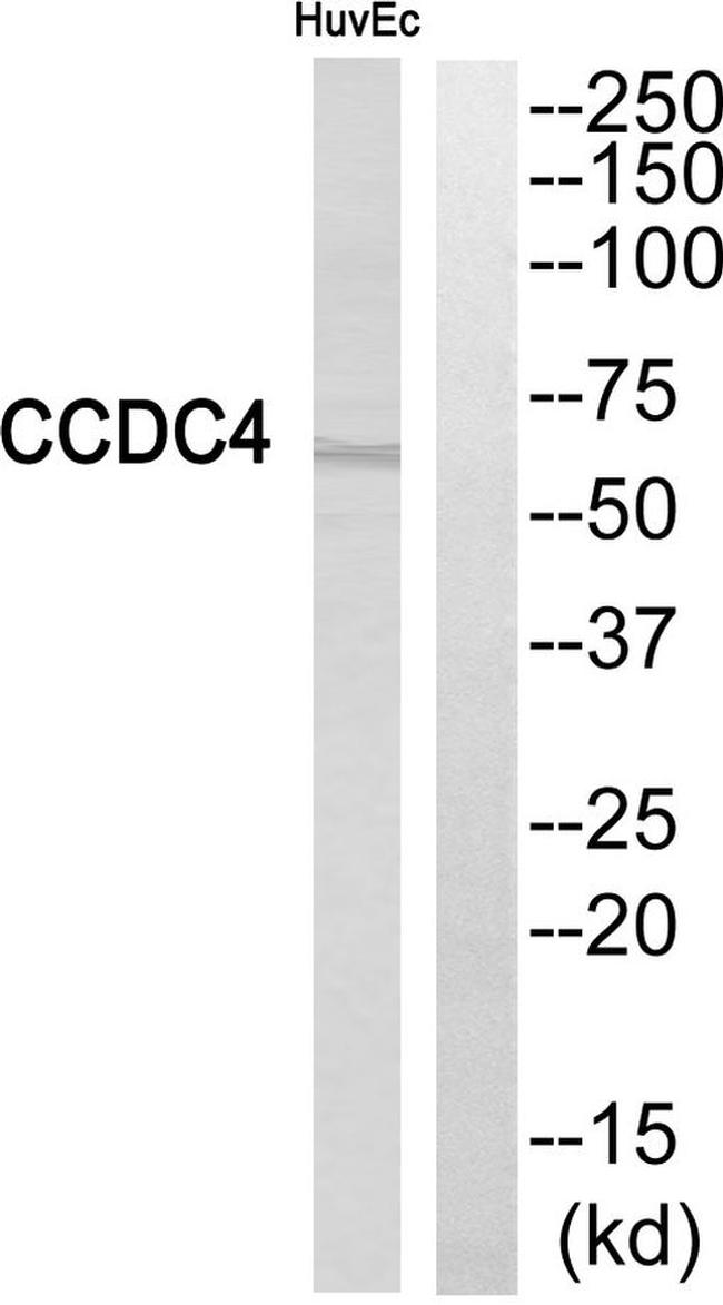 BEND4 Antibody in Western Blot (WB)