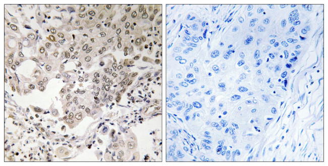NCAPG2 Antibody in Immunohistochemistry (Paraffin) (IHC (P))