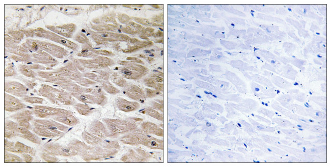 CCP2 Antibody in Immunohistochemistry (Paraffin) (IHC (P))