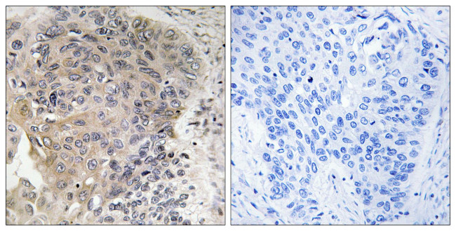 CCP3 Antibody in Immunohistochemistry (Paraffin) (IHC (P))