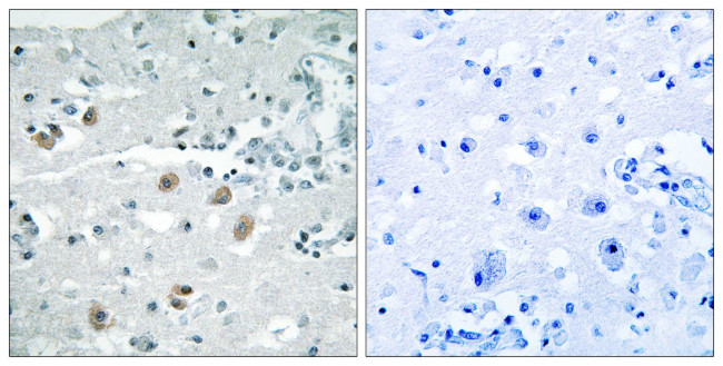 PLA2G4D Antibody in Immunohistochemistry (Paraffin) (IHC (P))