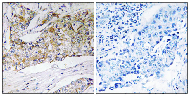 DHRS11 Antibody in Immunohistochemistry (Paraffin) (IHC (P))