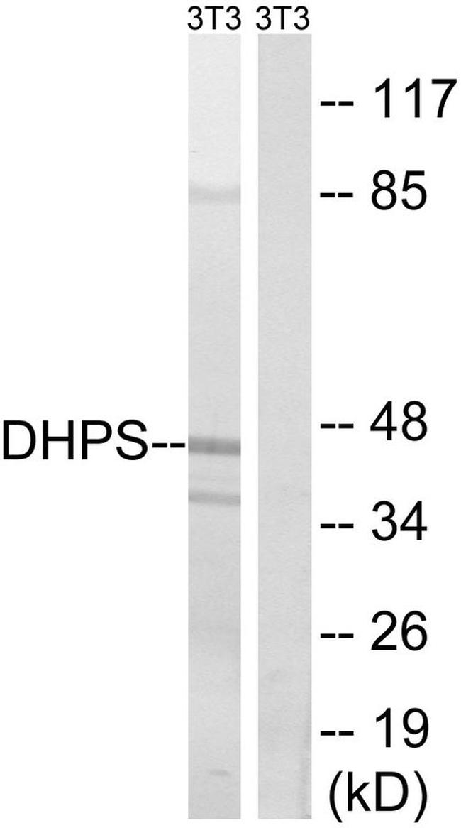 DHPS Antibody in Western Blot (WB)