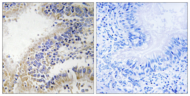 DHODH Antibody in Immunohistochemistry (Paraffin) (IHC (P))