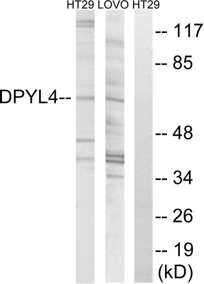 CRMP3 Antibody in Western Blot (WB)