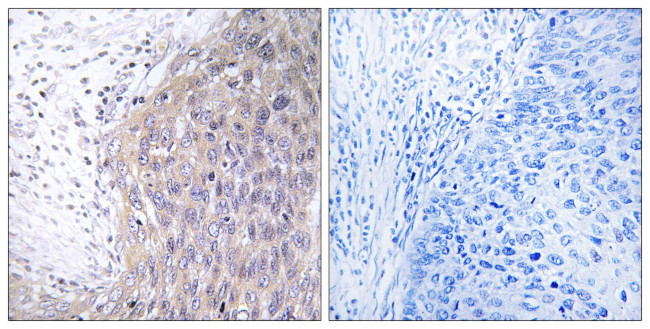 POLG2 Antibody in Immunohistochemistry (Paraffin) (IHC (P))