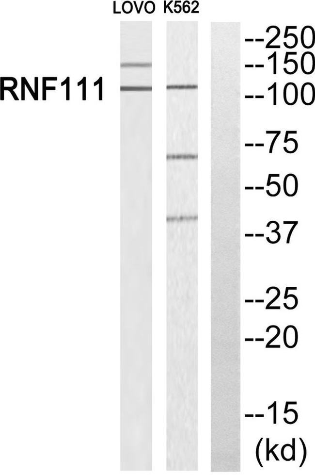 RNF111 Antibody in Western Blot (WB)