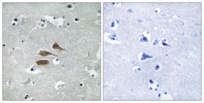 MARCH3 Antibody in Immunohistochemistry (Paraffin) (IHC (P))