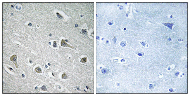 MYLIP Antibody in Immunohistochemistry (Paraffin) (IHC (P))