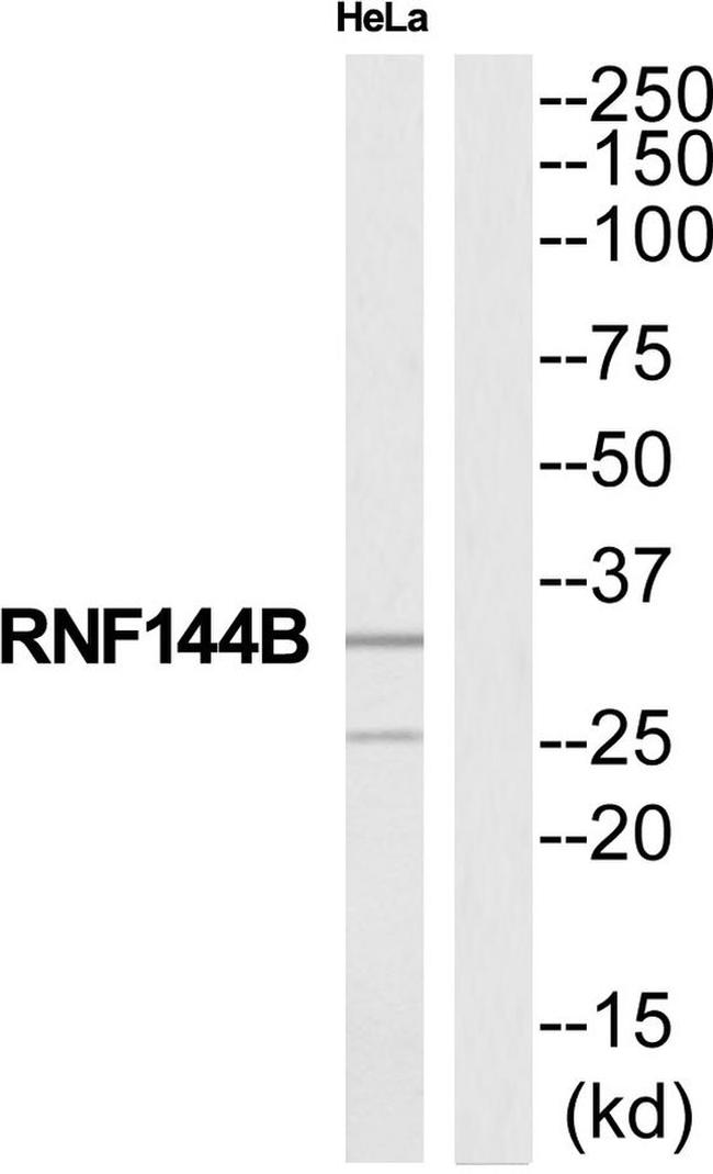 RNF144B Antibody in Western Blot (WB)