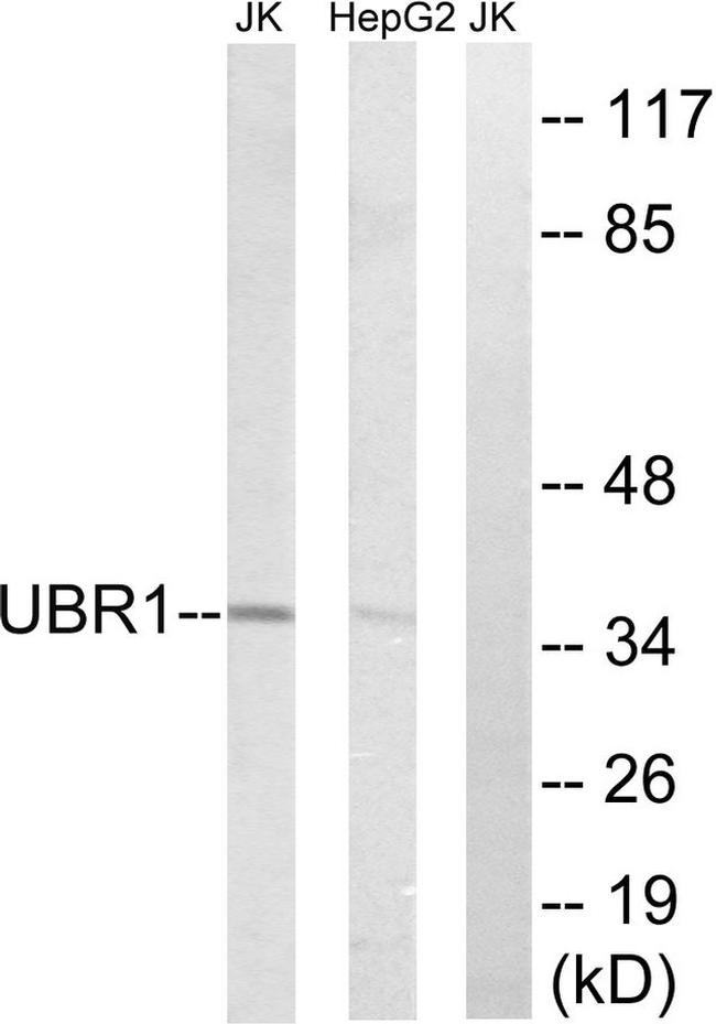 UBR1 Antibody in Western Blot (WB)