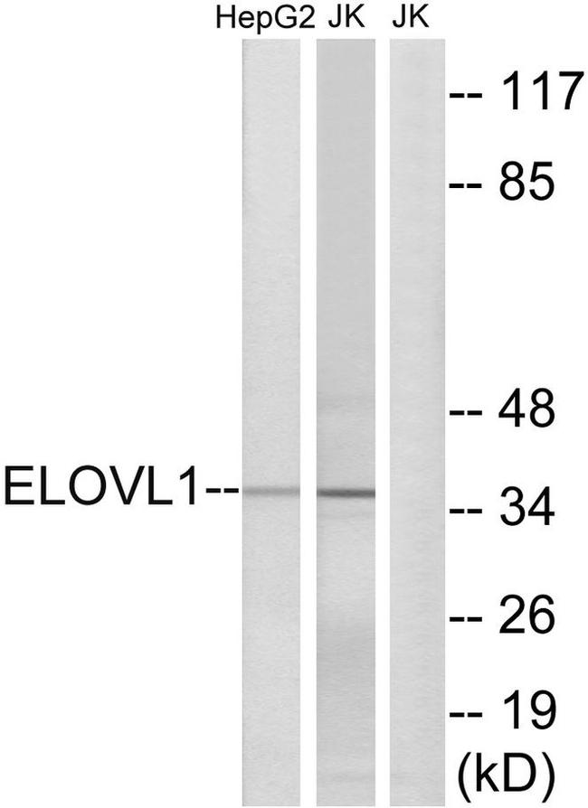 ELOVL1 Antibody in Western Blot (WB)
