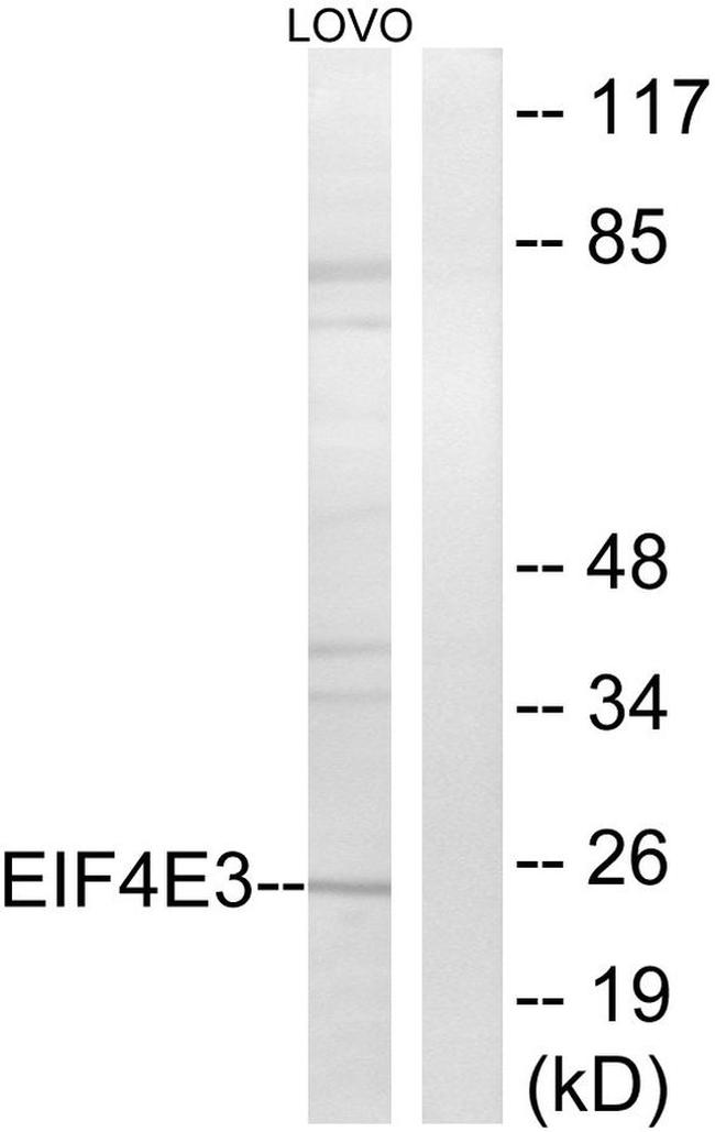 eIF4E3 Antibody in Western Blot (WB)