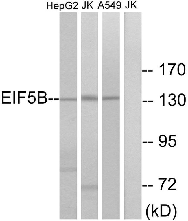 eIF5B Antibody in Western Blot (WB)