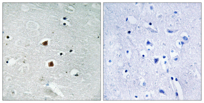 FOXJ3 Antibody in Immunohistochemistry (Paraffin) (IHC (P))
