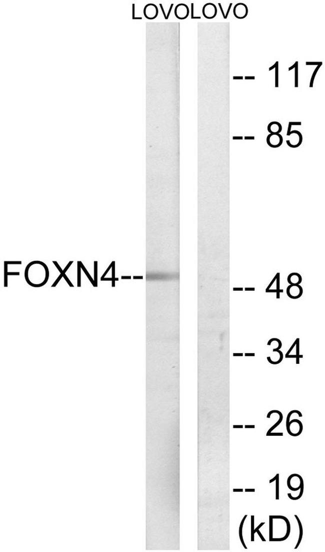 FOXN4 Antibody in Western Blot (WB)