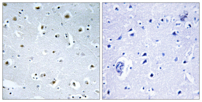GCP3 Antibody in Immunohistochemistry (Paraffin) (IHC (P))