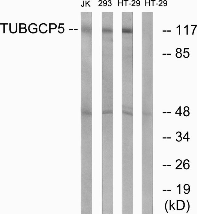 GCP5 Antibody in Western Blot (WB)