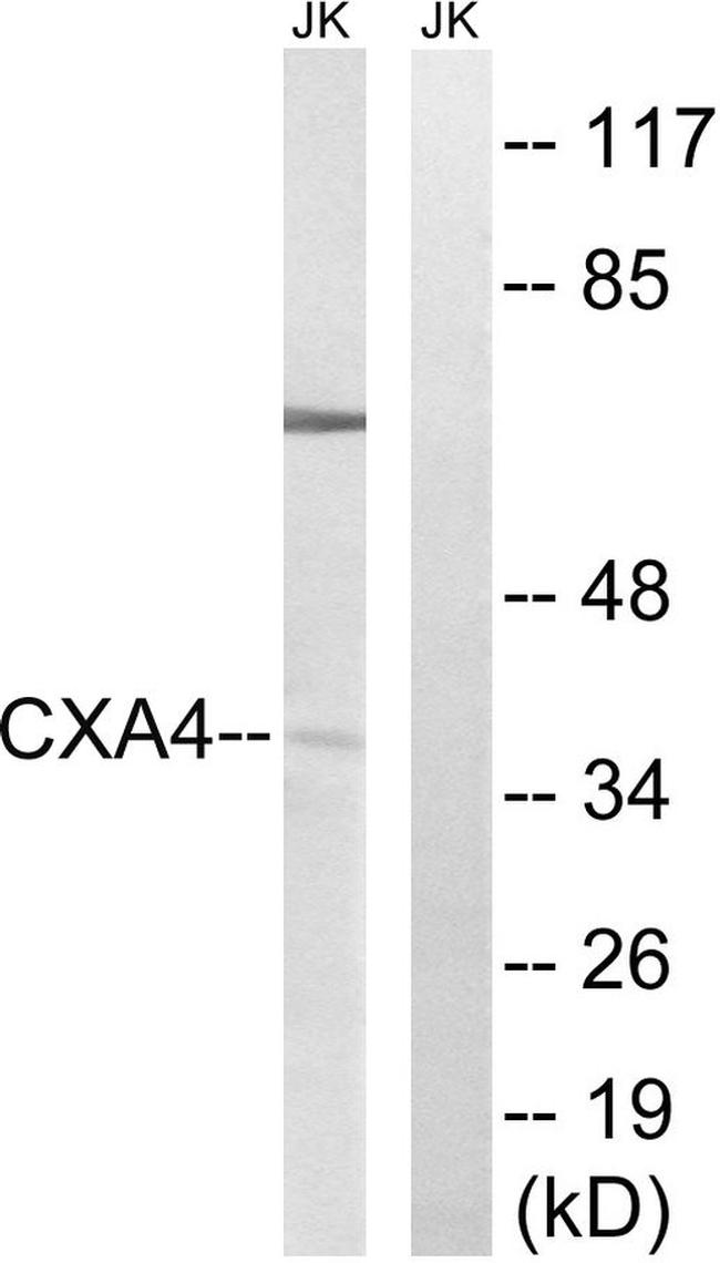 Connexin 37 Antibody in Western Blot (WB)