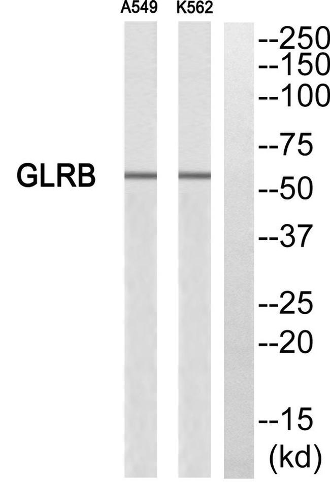 GLRB Antibody in Western Blot (WB)