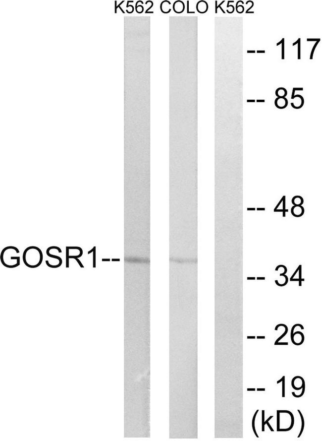GOSR1 Antibody in Western Blot (WB)