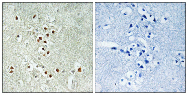 GADD45GIP1 Antibody in Immunohistochemistry (Paraffin) (IHC (P))