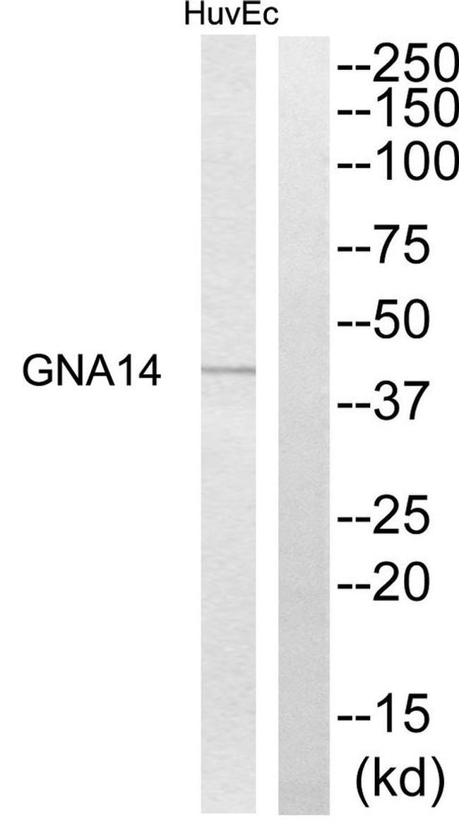 GNA14 Antibody in Western Blot (WB)