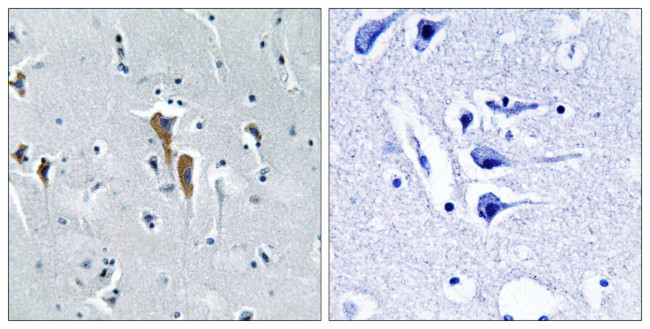 LIPC Antibody in Immunohistochemistry (Paraffin) (IHC (P))