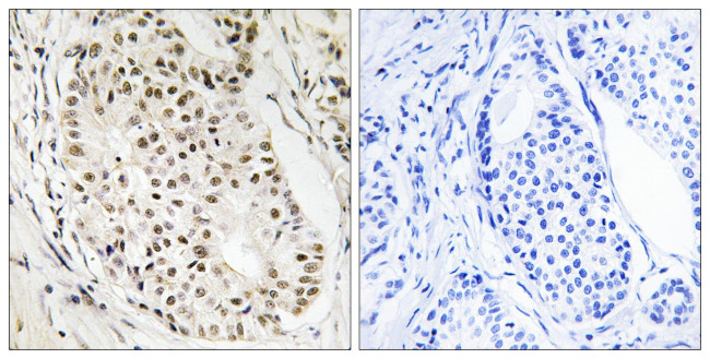 hnRNP UL2 Antibody in Immunohistochemistry (Paraffin) (IHC (P))