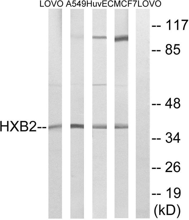 HOXB2 Antibody in Western Blot (WB)