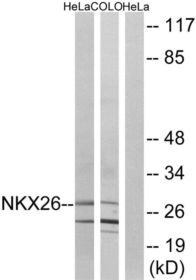 Nkx2.6 Antibody in Western Blot (WB)