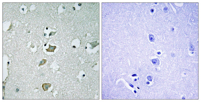Kir2.1 (KCNJ2) Antibody in Immunohistochemistry (Paraffin) (IHC (P))