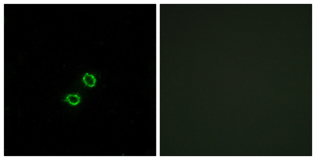 KIR2DL5B Antibody in Immunocytochemistry (ICC/IF)