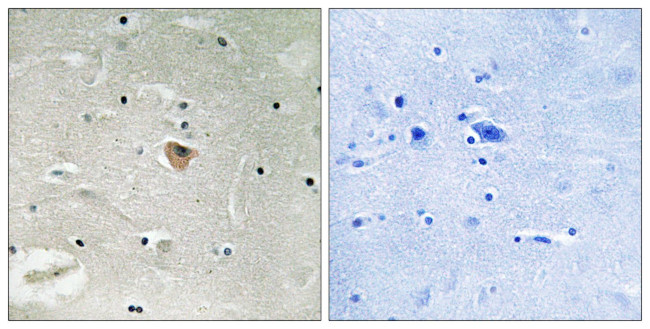 KIF13B Antibody in Immunohistochemistry (Paraffin) (IHC (P))