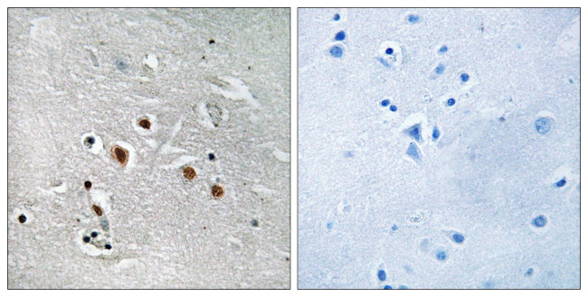 MED13L Antibody in Immunohistochemistry (Paraffin) (IHC (P))