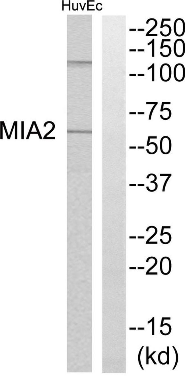 CTAGE5 Antibody in Western Blot (WB)
