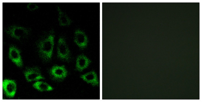 MBTPS2 Antibody in Immunocytochemistry (ICC/IF)