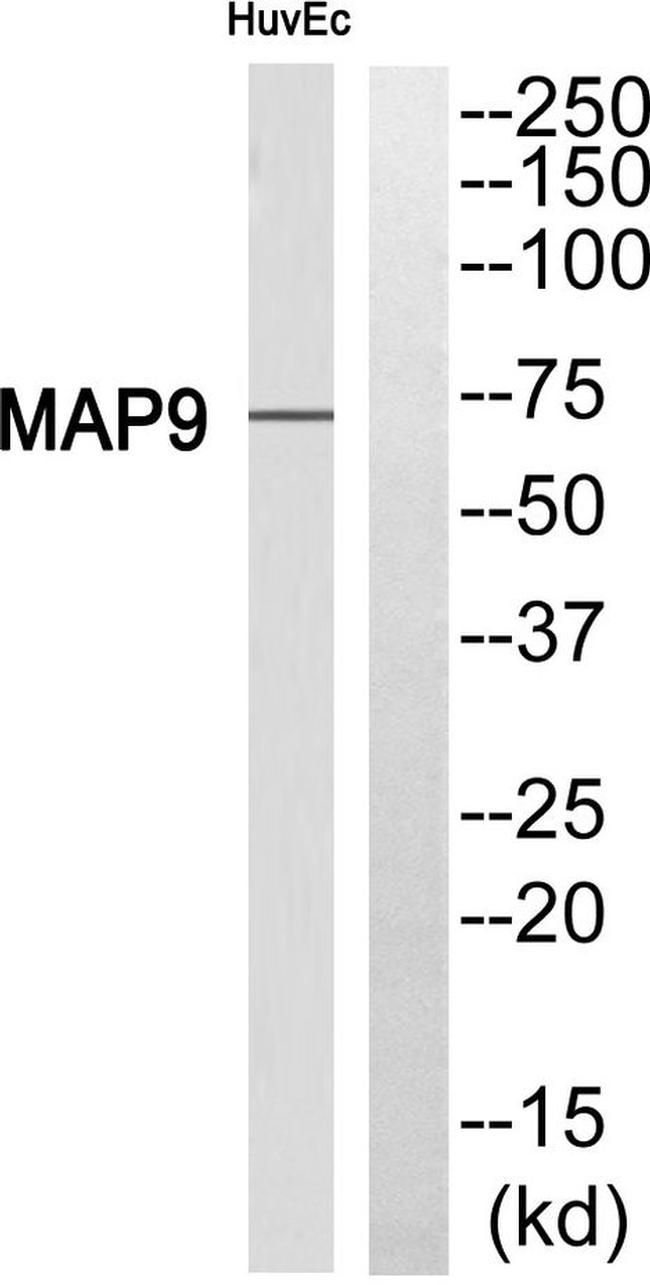 MAP9 Antibody in Western Blot (WB)