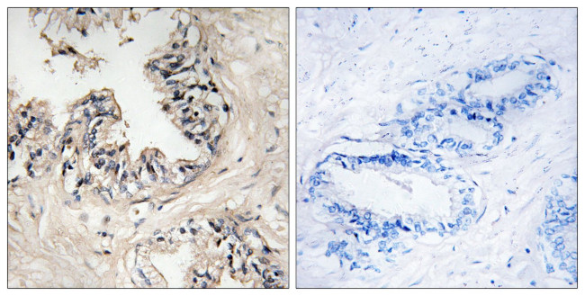 MRPS36 Antibody in Immunohistochemistry (Paraffin) (IHC (P))