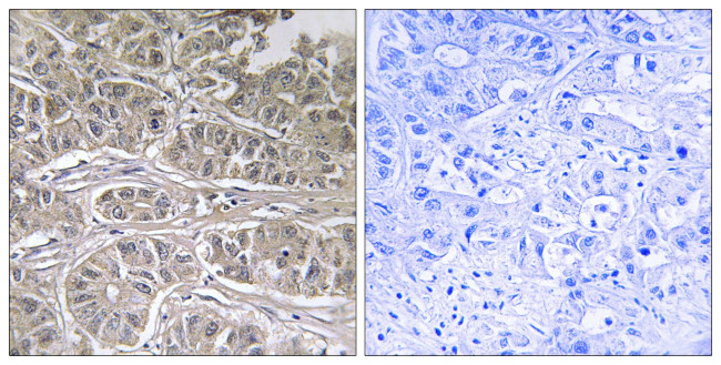 SLC25A21 Antibody in Immunohistochemistry (Paraffin) (IHC (P))