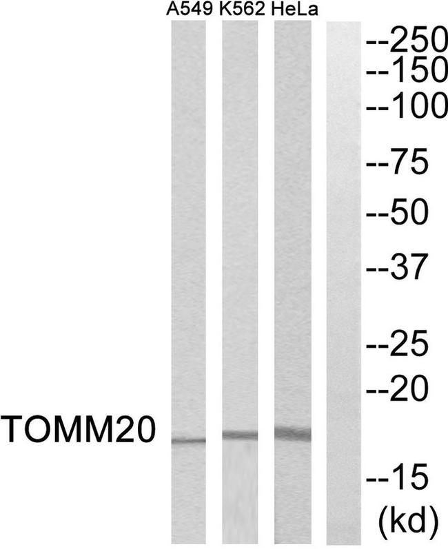 TOMM20 Antibody in Western Blot (WB)