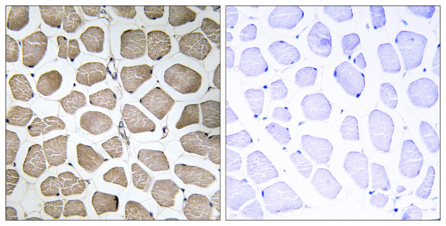 SLC16A12 Antibody in Immunohistochemistry (Paraffin) (IHC (P))
