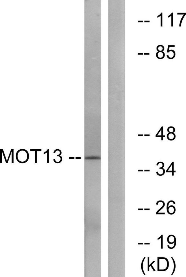 SLC16A13 Antibody in Western Blot (WB)