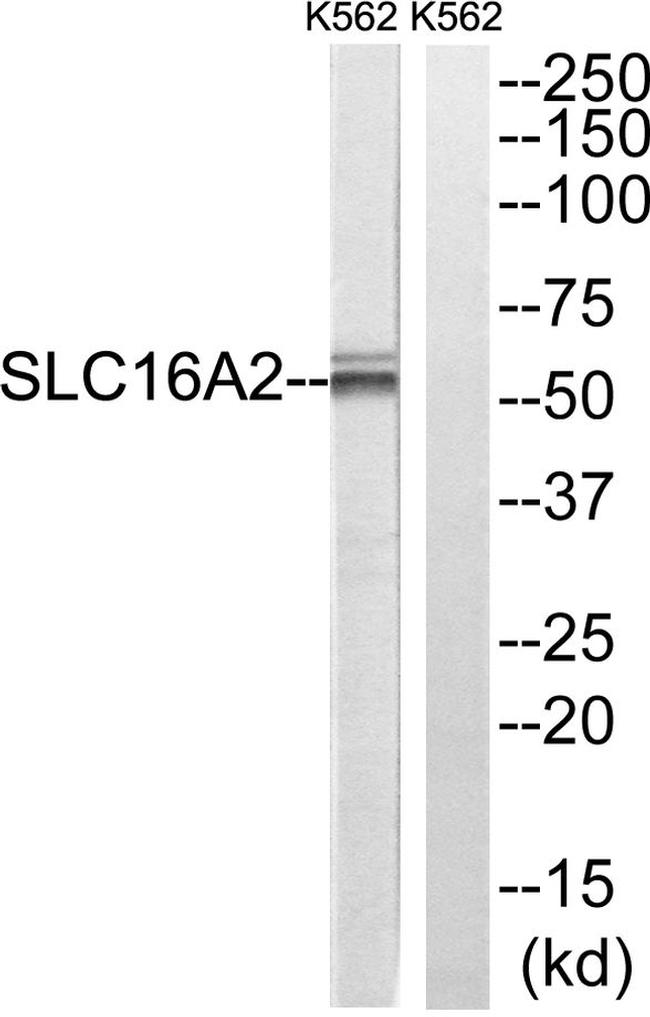 SLC16A2 Antibody in Western Blot (WB)