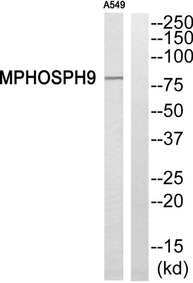 MPP9 Antibody in Western Blot (WB)