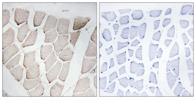 MYOM1 Antibody in Immunohistochemistry (Paraffin) (IHC (P))